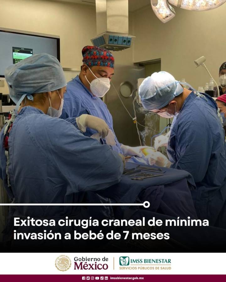 Exitosa cirugía craneal de mínima invasión a bebé de 7 meses 