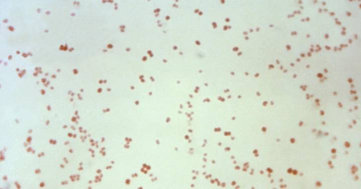 Sexually transmitted disease cases fall, but not syphilis in newborns