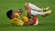 A James Rodríguez lo atendieron en Colombia vs Bolivia; durísima patada contra el ‘10’