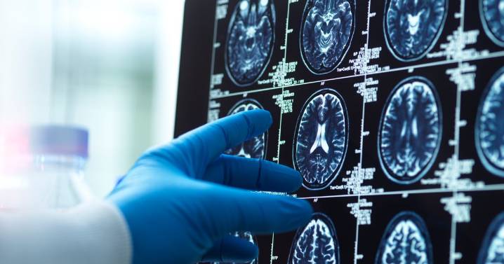 What is Huntington's disease as incurable condition treated successfully for first time?
