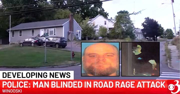Driver uses thumbs to nearly gouge man's eyes out in 'road rage' showdown: Police