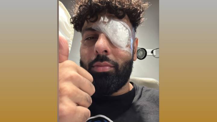 Singer Badshah injures his left eye during final show of the North America music tour