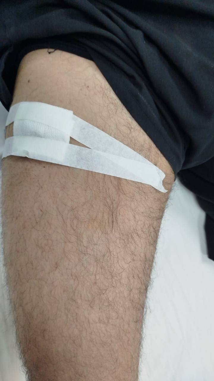 Un hombre resultó herido de bala en el barrio Antártida II y denunció al agresor