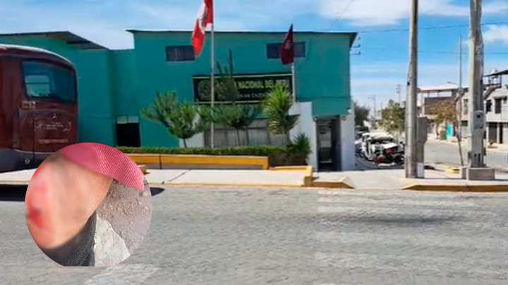 Investigan balacera que dejó a una mujer y a su perrito heridos en Yura