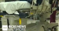 Maryland doctor explains why Black adults face heart failure earlier than white patients