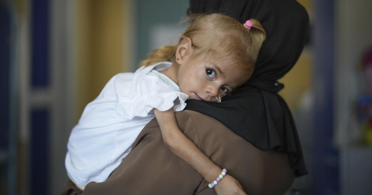 Toddler evacuated from Gaza with rare disease recovers from malnutrition in Italian hospital