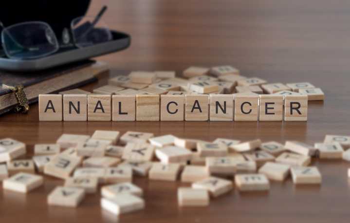 Further Clinical Considerations Needed For Anal Cancer Screening in People Living with HIV