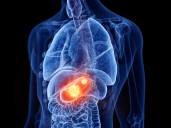 Exosomal Liquid Biopsy Shows High Accuracy for Early Gastric Cancer Detection