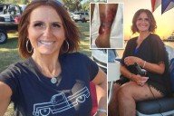 Mom Genevieve Gallagher nearly loses life and leg after contracting flesh