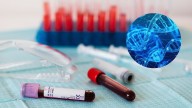 Científicos desarrollan una prueba capaz de detectar los primeros síntomas del cáncer de cuello y de cabeza