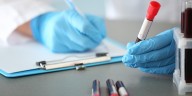 Se está desarrollando la primera detección de cánceres tempranos de cabeza y cuello