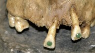 Los mayas se atrevieron a incrustar gemas de jade incluso en dientes de niños de apenas siete años como símbolo de madurez social