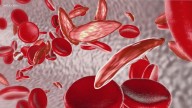 Columbia boosts sickle cell awareness in September