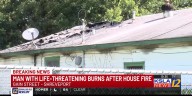 Man in life-threatening condition following house fire