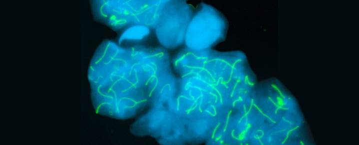 Oddball Creature Has 229 Chromosome Pairs, a Record in The Animal Kingdom