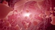 Huntington's disease successfully treated in 1st major breakthrough