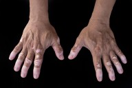 New Data at EADV Could Offer Hope, Address Gaps in Dermatology Care
