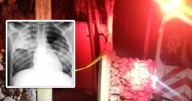 Consternación en Yobaín por muerte de menor a causa de neumonía