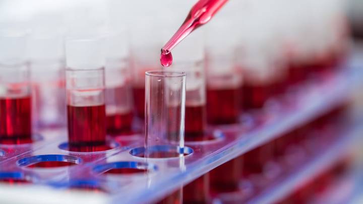 El peor tipo de sangre: estudio científico explica por qué este grupo de sangre tiene más tendencia a sufrir infartos