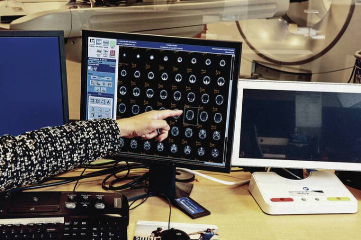 Letter: Alzheimer’s act will aid Native Hawaiians