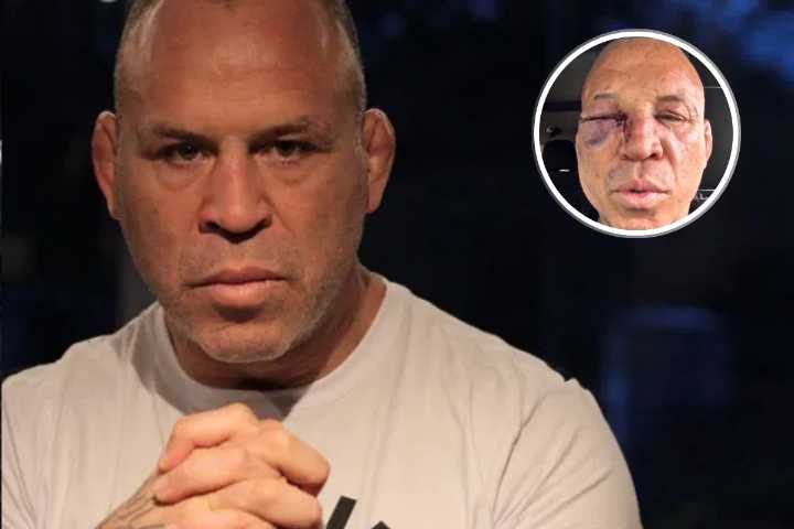 “I Have a Lot of Headaches”: Wanderlei Silva Rushes for Tests After Getting Knocked Out in Post