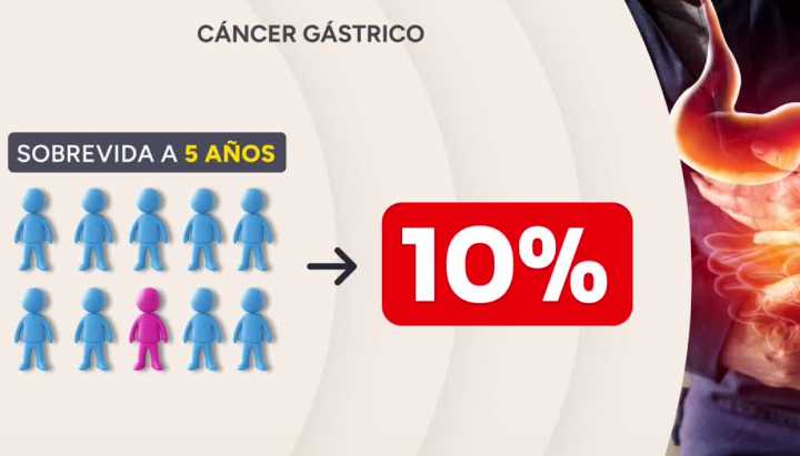 Cáncer gástrico: Ojo con la indigestión en Fiestas Patrias