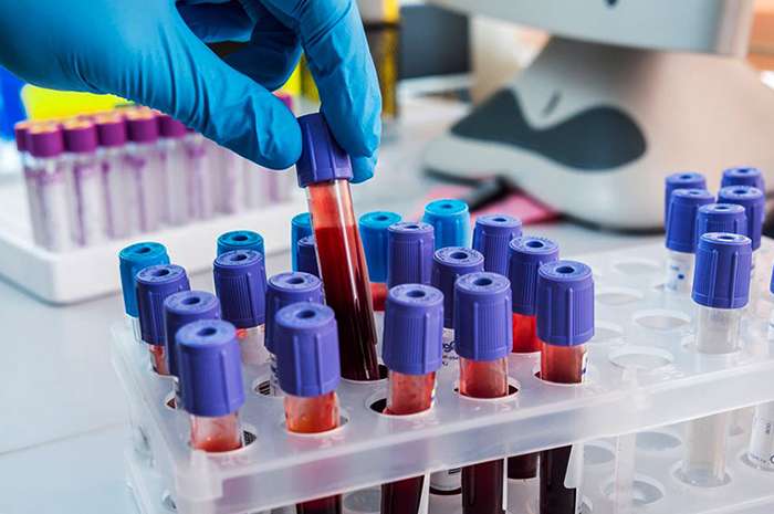 Farmacéuticos y bioquímicos rechazaron proyecto oficial que flexibiliza el control de importados