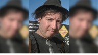 Un músico mendocino recibió una brutal golpiza y pelea por su vida en el hospital Central