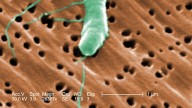 La letal bacteria ‘come carne’ pone en alerta a expertos en EE. UU.: “definitivamente, esto no es normal”