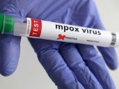 Mpox no longer international health emergency but remains concern in Africa