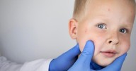 Child in Los Angeles Dies of Rare Brain Disorder Caused by Measles