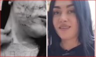 Así quedó el rostro de comerciante tras ataque en Bogotá