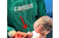 Nace bebé sano y salvo... ¡con el DIU en la mano!