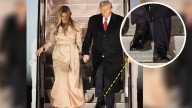 Trump’s Swollen Ankles Spark Health Questions During U.K. Visit Amid Protests