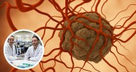 Descubren “caja negra” del cáncer: logran rastrear origen de los tumores y predecir progresión