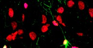 Las enfermedades mentales, el alcohol y las drogas lastran la producción de neuronas nuevas