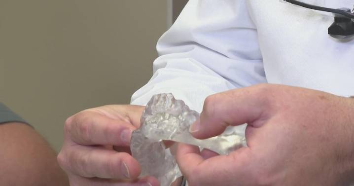 How 3D printing at UPMC makes "jaw in a day" surgery possible