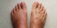 ¿Qué te dicen tus pies? Algunos síntomas podrían alertarte sobre enfermedades graves