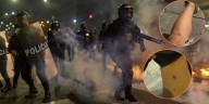 Periodistas heridos por perdigones de la PNP durante la marcha de la Generación Z en Lima