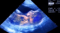 The first ‘designer babies’ are here – but can they really be more intelligent?