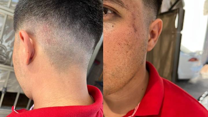 Mujer denuncia que su esposo fue arrestado injustamente durante riña en Torreón; ahora lo acusan de herir a un policía