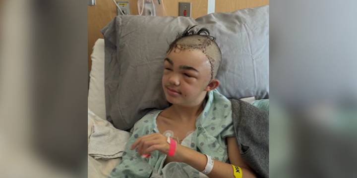 Parents say middle schooler was attacked by another student in cafeteria, had to have parts of skull removed