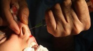 Cirugías estéticas en menores aumentan: Coprised