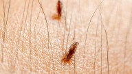 Cases of body lice reported at University of Maryland