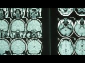 Study shows how thumbs helped shape the brain