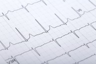 Deep Learning Approach Shows Promise for Automatic Assessment of Schizophrenia Using Wearable Technology