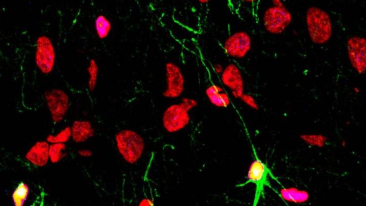 El consumo de alcohol daña la producción de neuronas y los vasos sanguíneos del cerebro