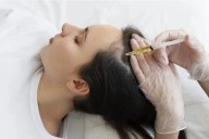 Mesoterapia capilar: El tratamiento que promete dar fuerza y vida al cabello