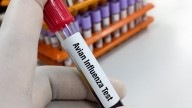 Bird flu detected in Henry County  backyard flock