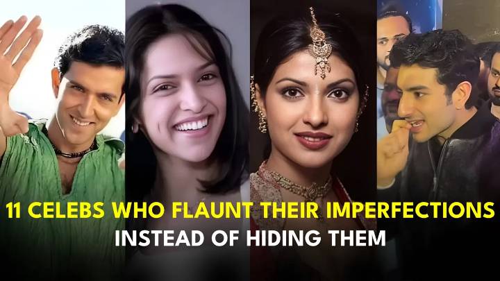 11 Celebs Who Flaunt Their Imperfections Instead of Hiding Them